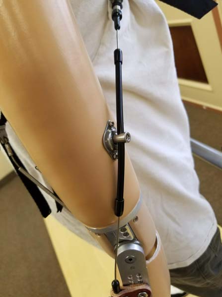 Modular Cable System (MCS) Components for Artificial Arm Prosthetics