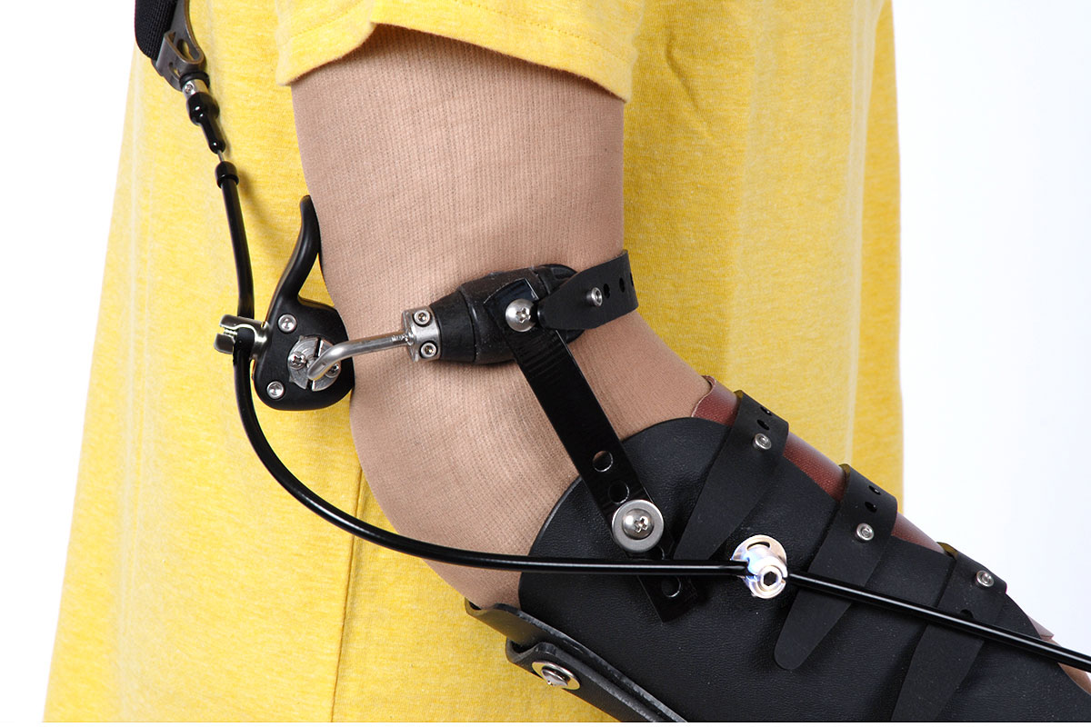 Humeral Suspension Cuff Arm Prosthetic